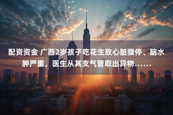 配资资金 广西2岁孩子吃花生致心脏骤停、脑水肿严重，医生从其支气管取出异物……
